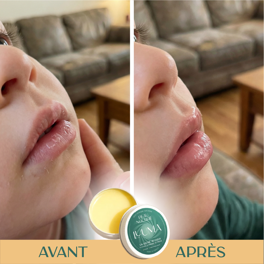 Aperçu de l'utilisation du baume sur les lèvres d'un enfant